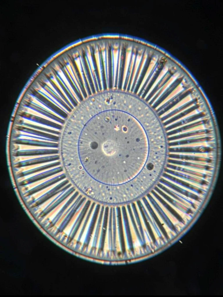 A thin section of a kidney stone in cross-polarized light — concentric birefring